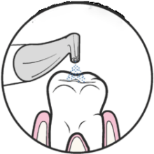ایرفلو دندانپزشکی ? - خرید و قیمت و فروش دستگاه ایرفلو دندانپزشکی - جرمگیری دندان با ایرفلو