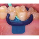 سیلیکون دم برند DMG - قیمت و خرید سیلیکون دم DMG - فروش تجهیزات دندانپزشکی خانه الماس - فروش آنلاین محصولات دندانپزشکی خانه الماس - دندانت